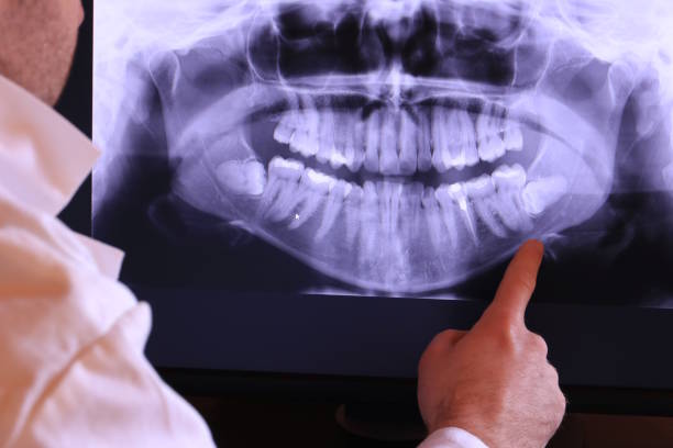Best Emergency Dental Care for Broken or Chipped Teeth in Roscoe, IL