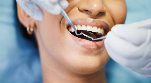 Best Emergency Tooth Extraction in Roscoe, IL