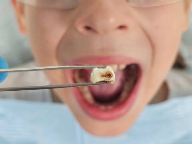 Best Weekend Emergency Dentist in Roscoe, IL